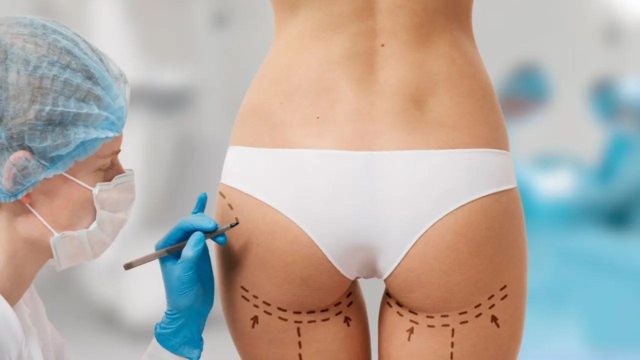 Remodelación glútea con AH o ácido poliláctico